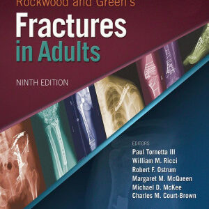 Rockwood and Green's Fractures in Adults 9th Edition vol 1 (PDF Instant Download)